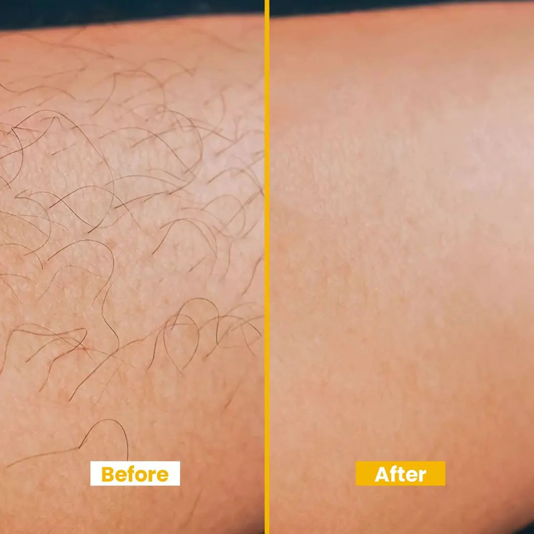 Lemon Hair Removal Cream with Vitamin E, – Swift & Soothing, Moisturizing Formula - 120ml