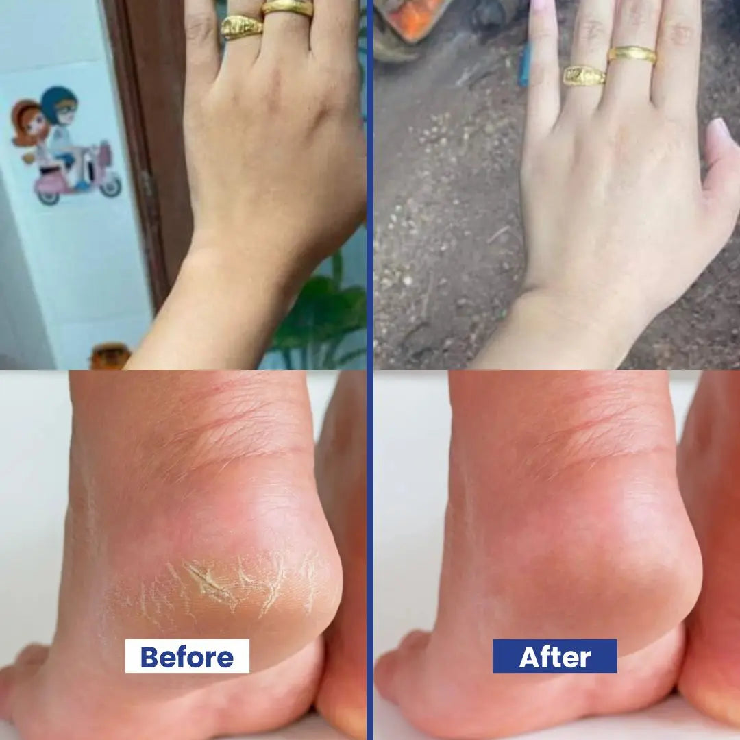 Hand & Feet Scrub with Vitamin E, Olive Oil & Jojoba Oil – Deeply Hydrates, Removes Dry Skin, Treats Cracked Heels, Exfoliates & Moisturizes for Smooth, Healthy Hands & Feet