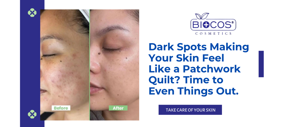 Dark Spots Making Your Skin Feel Like a Patchwork Quilt? Time to Even Things Out.