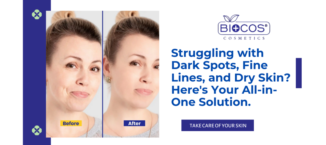 Struggling with Dark Spots, Fine Lines, and Dry Skin? Here's Your All-in-One Solution.