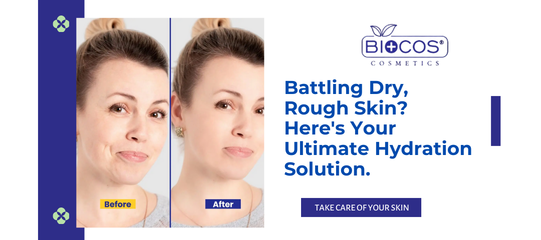 Battling Dry, Rough Skin? Here's Your Ultimate Hydration Solution.