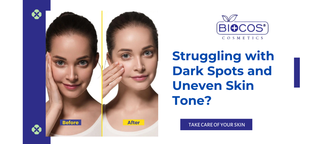Struggling with Dark Spots and Uneven Skin Tone?