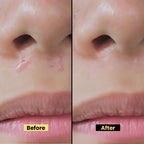 No Tache Cream | Anti-Eczema, Psoriasis Relief & Itch Soothing Formula with Azelaic Acid, Allantoin, Gold & Bisabolol | Hydrating & Restoring Cream for Sensitive Skin - 50gm