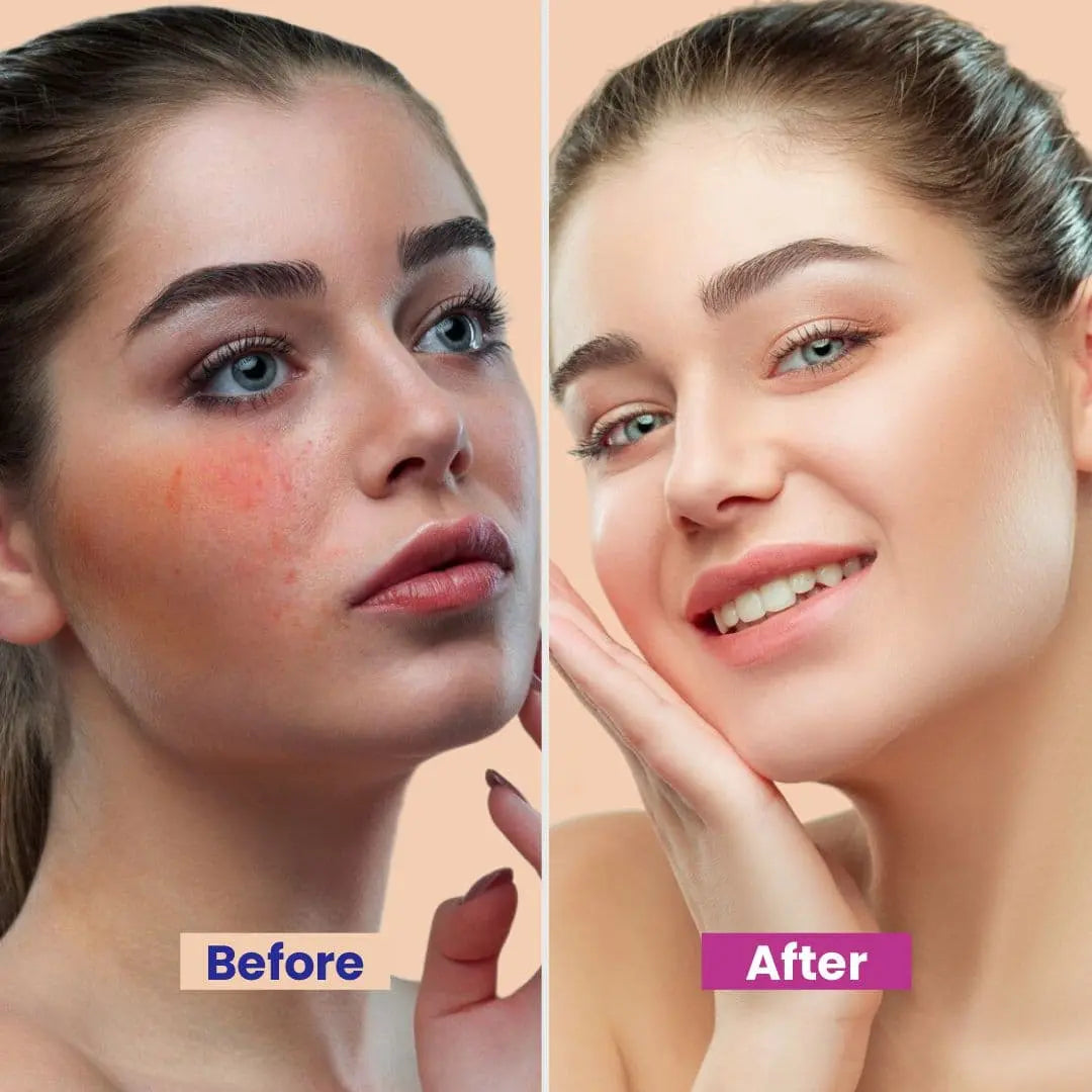Max Hydration Goldish Beauty Cream - Anti-Aging, Brightening & Hydrating Formula with Vitamin B6, Arbutin, Zinc Oxide for Dark Circles, Sun Damage & Even Skin Tone,  -  26gm