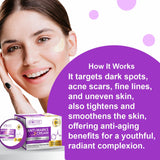 Anti Marks Cream – Dark Spot Remover & Acne Spot Treatment with Azelaic Acid, Niacinamide & Collagen | Brightening & Hydrating for Radiant, Whitening Skin | Anti-Aging & UV Protection - 16gm