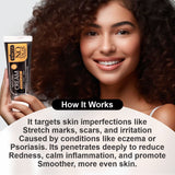 No Tache Cream | Anti-Eczema, Psoriasis Relief & Itch Soothing Formula with Azelaic Acid, Allantoin, Gold & Bisabolol | Hydrating & Restoring Cream for Sensitive Skin - 50gm