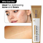 Anti Acne Cream for Blemishes, Scars & Breakouts – Hydrating Formula with Aloe Vera, Neem, Zinc Oxide & Bitter Gourd – Anti-Inflammatory & Skin Brightening,  - 12gm