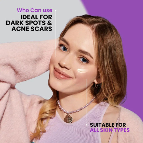 Anti Marks Cream – Dark Spot Remover & Acne Spot Treatment