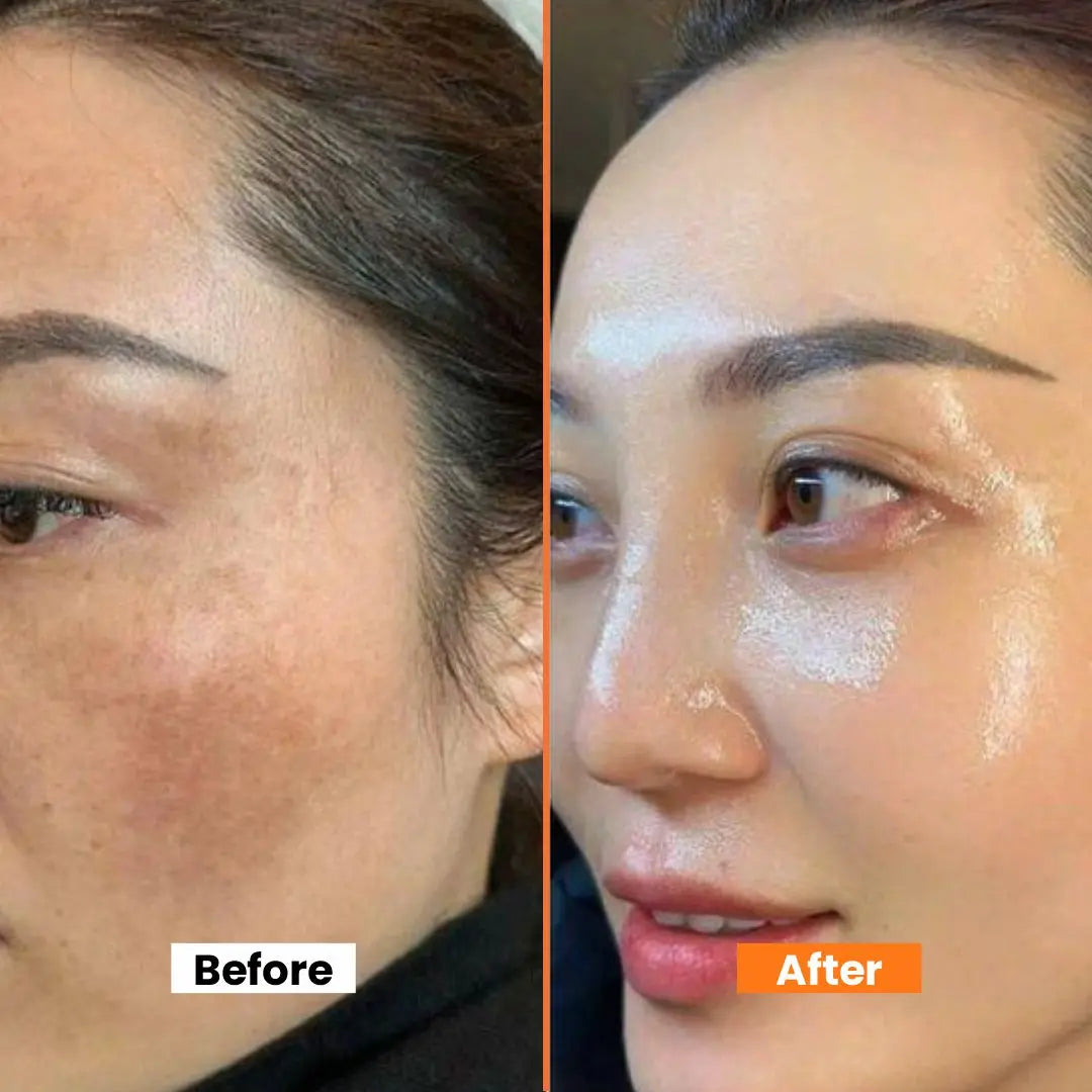 Dark Spot Correcting Cream | Brightening & Hydrating Formula with Sweet Almond Oil, Glycerin & Antioxidants | Fades Dark Spots, Pigmentation & Uneven Skin Tone - 50gm