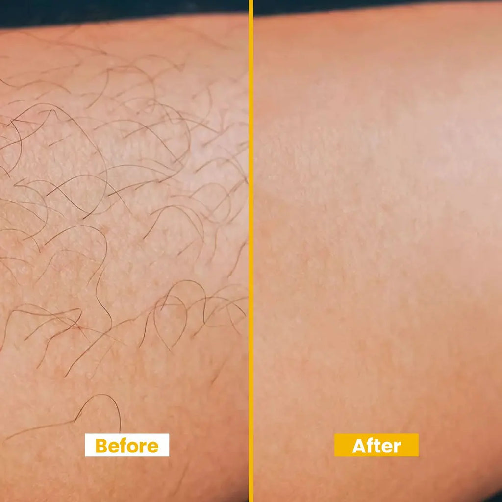 Lemon Hair Removal Cream with Vitamin E, – Swift & Soothing, Moisturizing Formula - 120ml