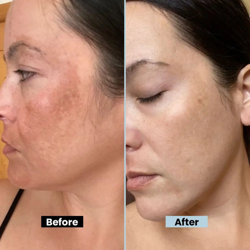 Glutathione Beauty Cream - Brighten & rejuvenate skin with Aloe Vera, Hyaluronic Acid & Shea Butter. Reduces dark spots & hyperpigmentation for a radiant glow - 40gm