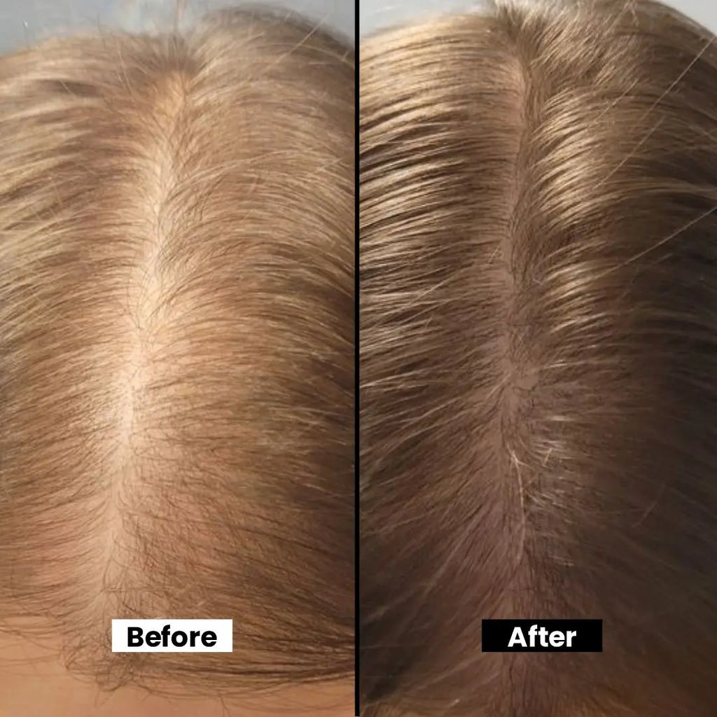 Herbal Hair Regrowth Oil - Nourishing Almond, Coconut & Black Seed Oils for Thicker, Stronger Hair - Promotes Natural Growth & Shine - 100ml