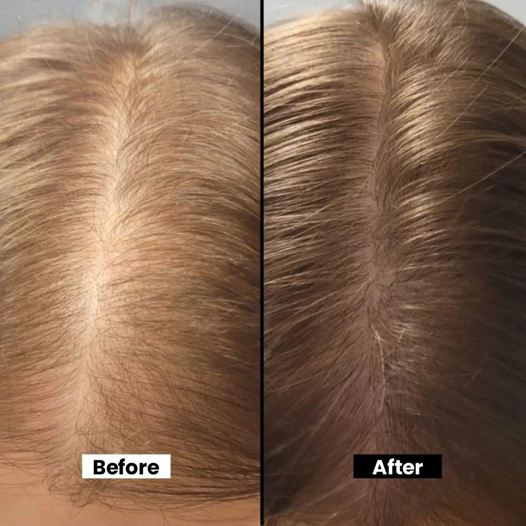 Herbal Hair Regrowth Oil - Nourishing Almond, Coconut & Black Seed Oils for Thicker, Stronger Hair - Promotes Natural Growth & Shine - 100ml
