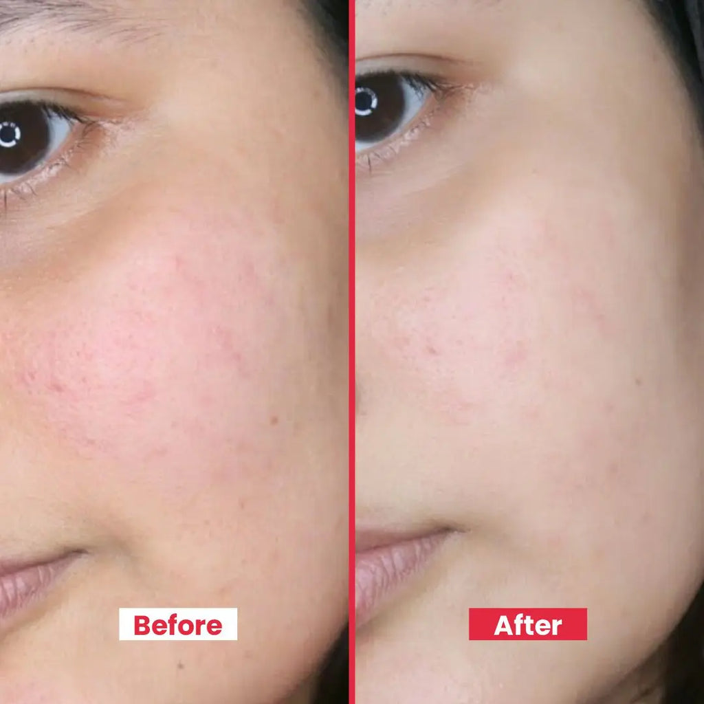 Organic Rose Water Spray – Hydrating Toner, Reduces Redness & Tightens Pores