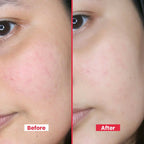 Organic Rose Water Spray – Hydrating Toner, Reduces Redness & Tightens Pores