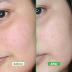 Cucumber Water Mist | Soothing & Hydrating for Redness Relief