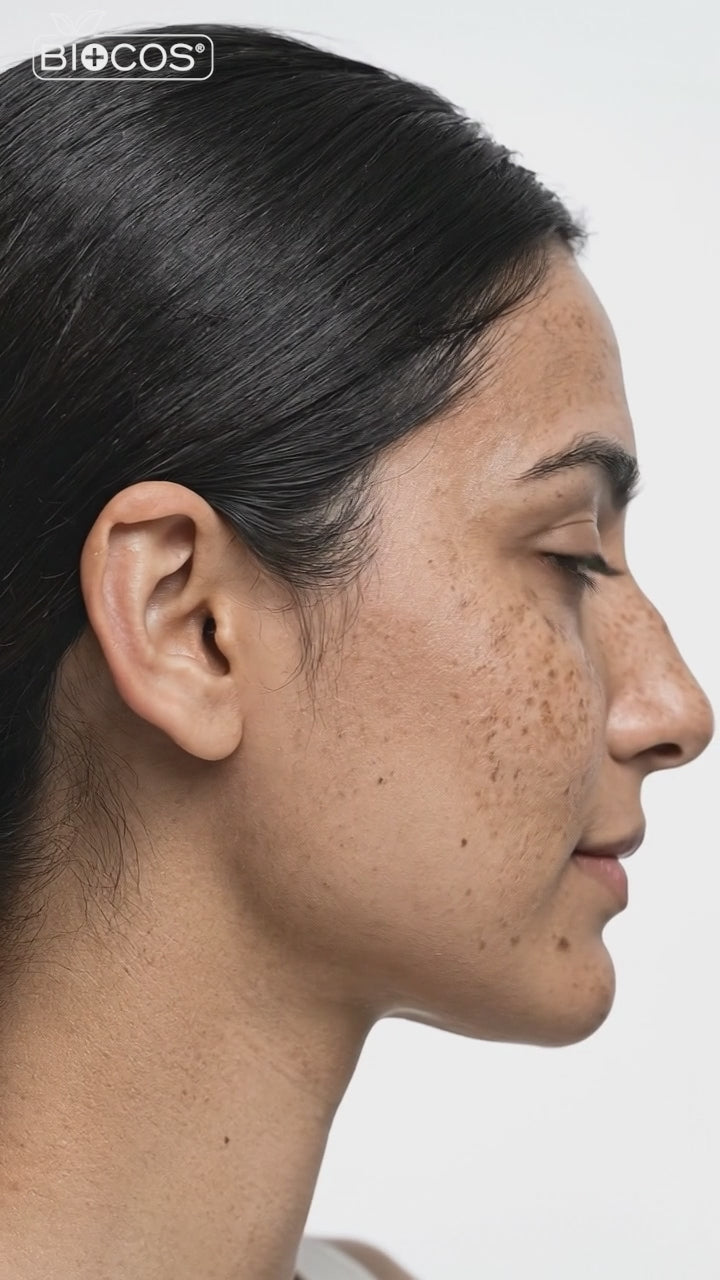 Melasma Rx Cream for Hyperpigmentation, Dark Spots & Discoloration | Hydrating & Brightening